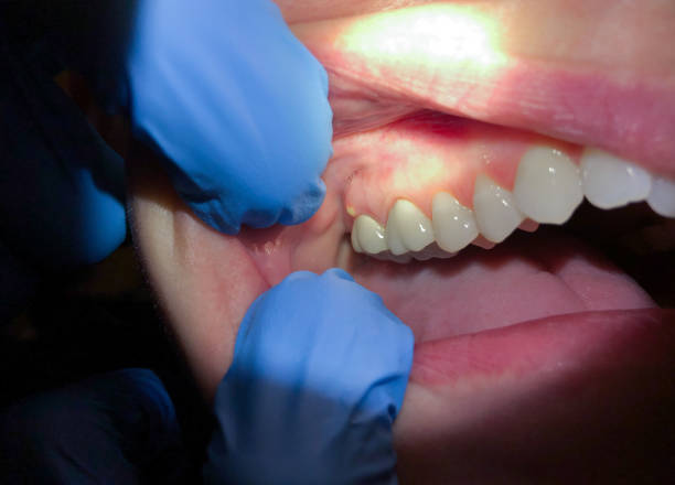 Best Orthodontic Emergency Dentist in Nazareth College, NY